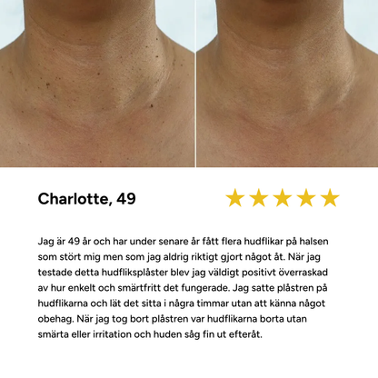 DermaPatches - Bli av med hudflikar smärtfritt